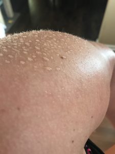 my sweaty shoulder after a run